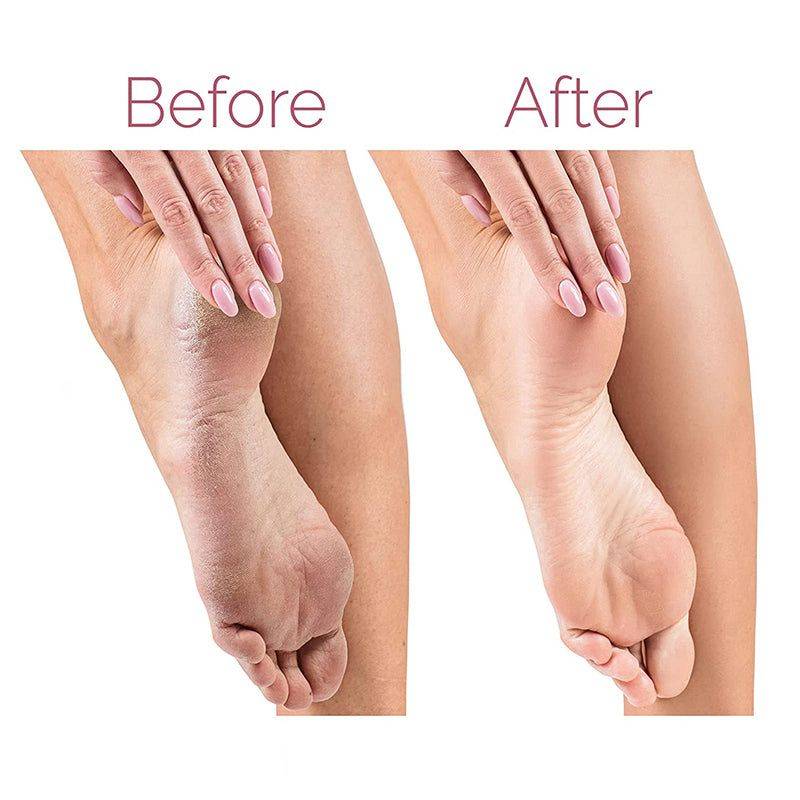 Flawless Pedi Pedicure Tool